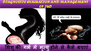 Diagnostic Evaluation and Management of IUD  FULL EXPLANATION IN HINDI BY NG MEDICALS [upl. by Tyra]