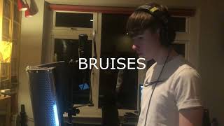 Bruises  Lewis Capaldi Cathal Mulvey Cover [upl. by Ynaffital831]