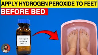 Hydrogen Peroxide The Secret Healer for Your Feet [upl. by Dijam]