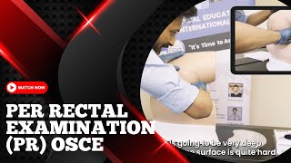 Abdominal Exam  OSCE Tips osce geekymedics clinicalskills medstudent medschool  UKMLA  CPSA [upl. by Rramel693]