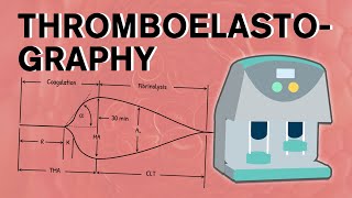 Thromboelastography [upl. by Crescint]