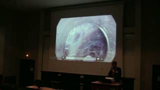 Cas cliniques vidéo d’endoscopie  Dr Jérémie JACQUES Limoges CHU [upl. by Ernesto700]