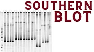 Southern blot  Southern blotting technique explained [upl. by Lenora]