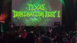 Epicardiectomy Live Haltom City TX 9282024 [upl. by Colston]