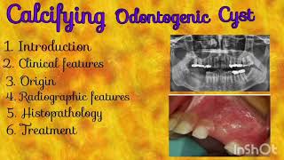 Calcifying Odontogenic Cyst  Oral Path  The Dentistry Girl [upl. by Sorenson556]