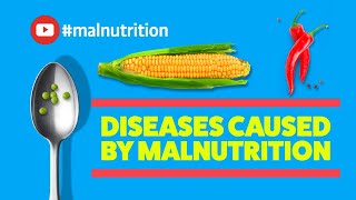 Diseases Caused by Malnutrition  SCURVY RICKETS BERIBERI PELLAGRA [upl. by Everrs]