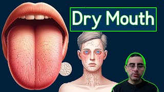 Top 7 Causes of Dry Mouth Xerostomia and Treatment [upl. by Glialentn389]