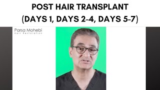 FUE Hair Transplant Post Hair Transplant Care Day 1 Day 24 Day 57 [upl. by Rior]