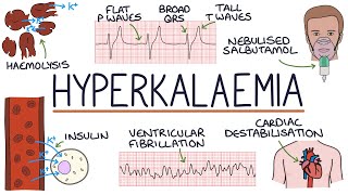 Understanding Hyperkalaemia High Potassium [upl. by Alasdair]