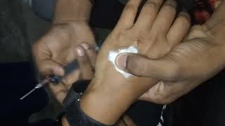 iv injection vilog video Indian girl Injection on hip crying vlog  Buttock Injection Kaise lagaye [upl. by Naujal]