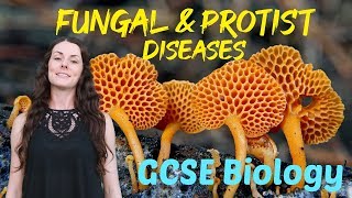 Fungal and protist diseases  GCSE Biology Revision for 2020 [upl. by Earvin311]