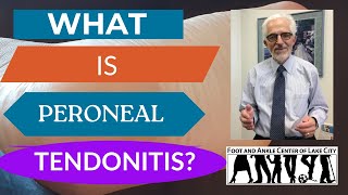 Peroneal Tendonitis What Is It and How Is It Treated [upl. by Rotce538]