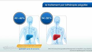 Comment traiter l’hépatite C [upl. by Assiram]