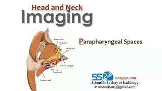 7 parapharyngeal spaces imaging  profMamdouh Mahfouz 2019 edition [upl. by Alethia]