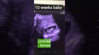 Baby measurementsGestational sac measurements pregnancy [upl. by Liamaj704]