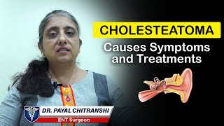 Cholesteatoma Causes Symptoms and Treatments  Middle Ear Infections Treatment  Dr Payal Chitranshi [upl. by Lula865]