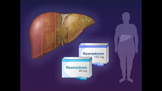 Resmetirom for NASH with Liver Fibrosis  NEJM [upl. by Madi268]