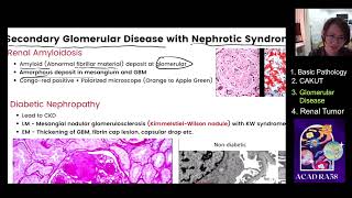 RAID211 Lecture 13 Glomerular disease part 3 by Ice RA58 [upl. by Yi839]