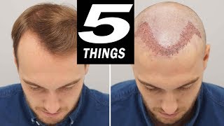 5 THINGS to do after HAIR TRANSPLANT [upl. by Malin979]