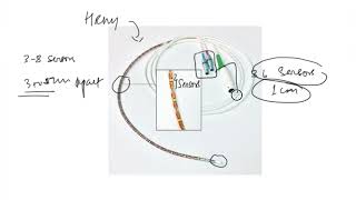 Esophageal motility disorders [upl. by Kara]