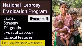 National Leprosy Eradication Program  Diagnosis amp Types of Leprosy  psm community norcet nurse [upl. by Torre408]