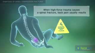 Spinal Compression Fracture Symptoms [upl. by Armilla]