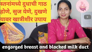 स्तनांमध्ये दुधाची गाठ होणे सुज येणे दुखणे यावर उपाय  Engorged breast and blocked milk duct marathi [upl. by Lytsyrk832]