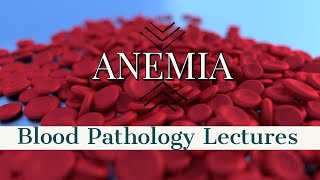 ANEMIA lecture 8 HERIDITARY SPHEROCYTOSIS in simple way [upl. by Kancler]