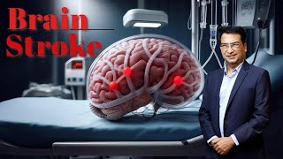 Understanding Brain Strokes Effects Symptoms amp Treatment  Expert Insights with Dr Praveen Gupta [upl. by Eehc]