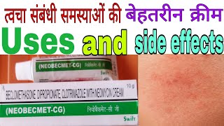 Neobecmet CG Cream Benefits and side effects in Hindi [upl. by Erlina]