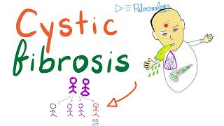 Cystic Fibrosis  Definition Pathogenesis Symptoms and Complications  Genetics [upl. by Daeriam]