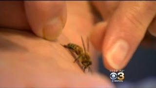 Health Bee Sting Therapy Can Help Common Health Problems [upl. by Swetlana21]