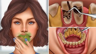 ASMR Remove giant tartar stuck between teeth  Dental care animation [upl. by Ris]