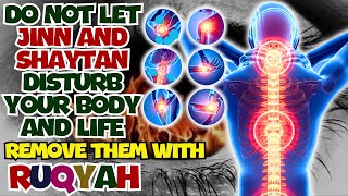 Burn the Jinn and Satan that disturb your body with Ruqyah [upl. by Niklaus]