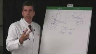 What is the Whipple Procedure [upl. by Vachill809]