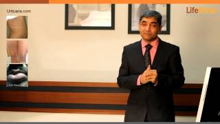 Chronic Urticaria Treatment with Homeopathy Explains Dr Shah [upl. by Nosiddam]