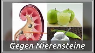 5 nützliche Hausmittel gegen Nierensteine  Besser Gesund Leben [upl. by Leveroni]