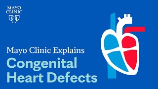 Mayo Clinic Explains Congenital Heart Defects [upl. by Reve957]