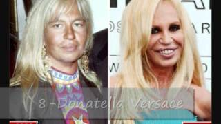 Le top 12 des pires ratages en chirurgie esthétique chez les stars [upl. by Shenan500]