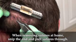 Dr Brett Bolton Suture Removal Short [upl. by Draner309]