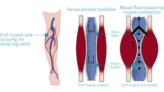 Soleus Muscle  Trigger Point Anatomy  Referred Pain [upl. by Margreta]