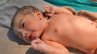 Lethargy baby due to prolonged labourafterbirthplus newbornbaby tredingshorts babieslife cute [upl. by Edme]