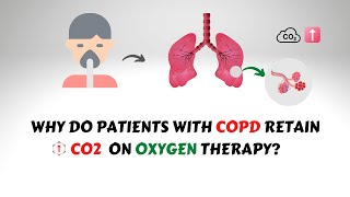 Oxygen Induced CO2 Narcosis in COPD Patients [upl. by Davine]