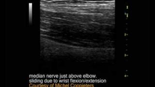 The median nerve slides and glides [upl. by Margit]