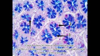 Large Intestine under the microscope with Alcian Blue PAS stain for mucin [upl. by Oiznun]