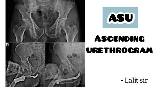 Ascending urethrogram  ASU  scparamedicalinstitute8221 [upl. by Selene]