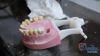 full crown preparation for posterior and anterior teeth [upl. by Mathis]