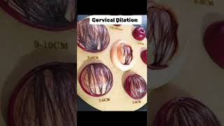 Cervical Dilation cervix cervical pregnant midwife [upl. by Dutchman]