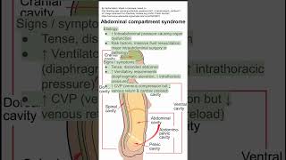 Abdominal Compartment syndrome [upl. by Getraer]