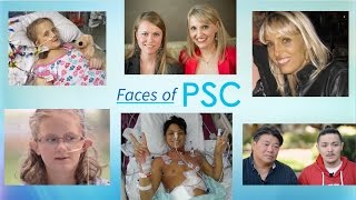 Faces of Primary Sclerosing Cholangitis PSC [upl. by Evangelin]